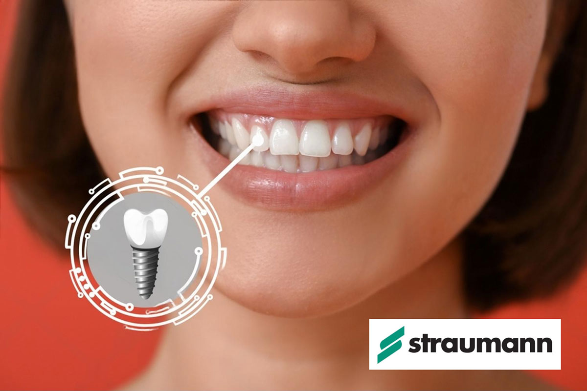 ceramic tooth implant metal free