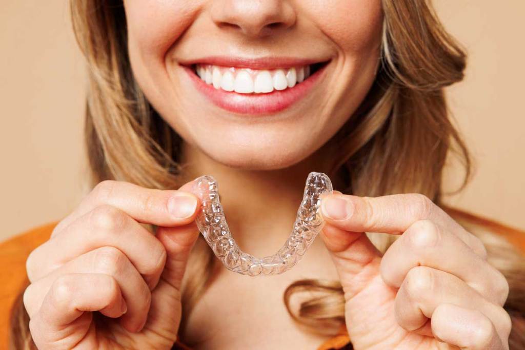 What Is Invisalign Braces Uk